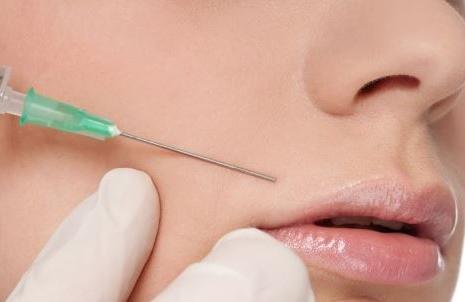 注射填充法令紋的方式有哪些？如何通過醫(yī)美手段祛法令紋？