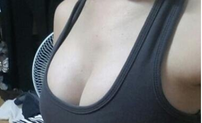 成都美立方(原華博)醫(yī)療美容醫(yī)院做假體隆胸術后的最終效果 成都美立方(原華博)醫(yī)療美容醫(yī)院做假體隆胸術后的最終效果