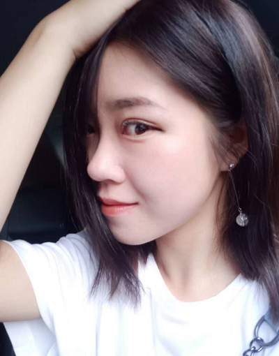 北京東方瑞麗醫(yī)療美容門診部做雙眼皮手術(shù)后的日?；謴?fù)情況