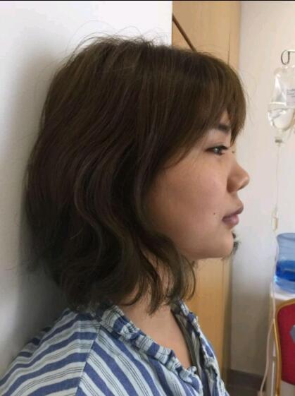 上海美萊醫(yī)療美容門診部做鼻綜合手術(shù)前
