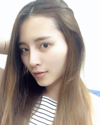 深圳微姿醫(yī)療美容門診部做鼻綜合手術(shù)后的日?；謴?fù)