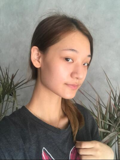  成都蜀尚蓉雅美容整形醫(yī)院陳秀榮鼻綜合案例效果分享