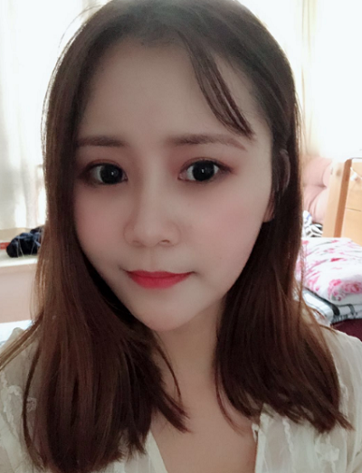 上海美萊醫(yī)療美容門診部做面部填充術(shù)后的最終效果