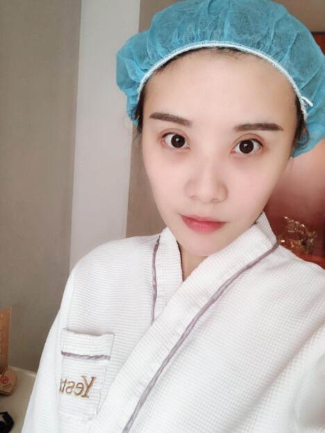 上海藝星醫(yī)療美容醫(yī)院做鼻綜合術(shù)前形狀