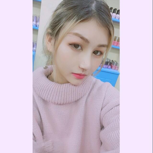 成都蜀尚蓉雅美容整形醫(yī)院做鼻綜合術(shù)后15天的情形